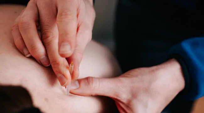 Dry Needling